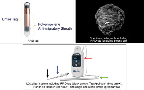 rf tag breast|radiofrequency identification technology.